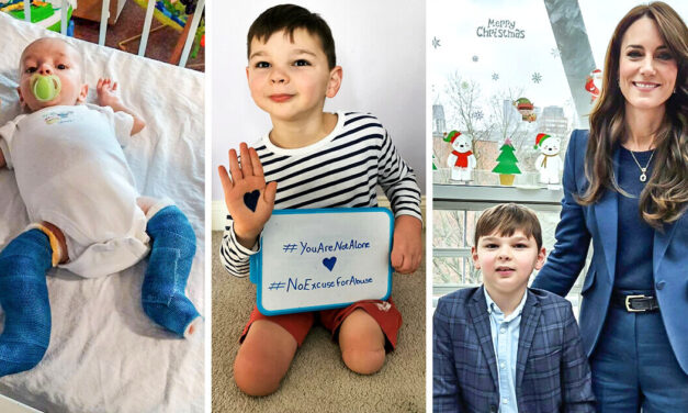 A Boy Who Lost Legs Due to Parents’ Mistreatment Finds New Family and Proves Love Can Heal Any Wounds