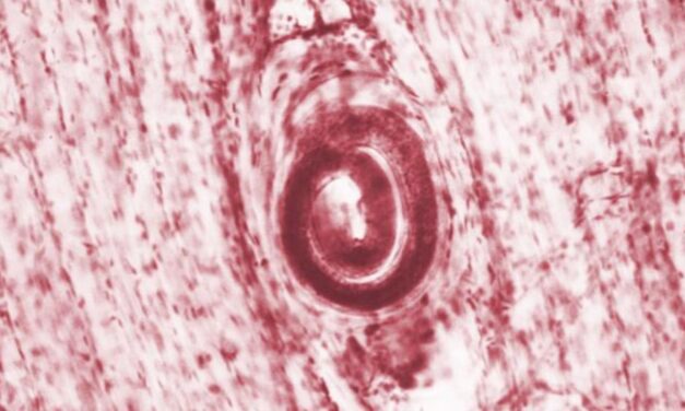 Parasitic worms infect 6 after bear meat served at family reunion