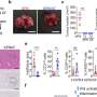 Genetic discovery paves the way for advanced pancreatic and colorectal cancer treatments