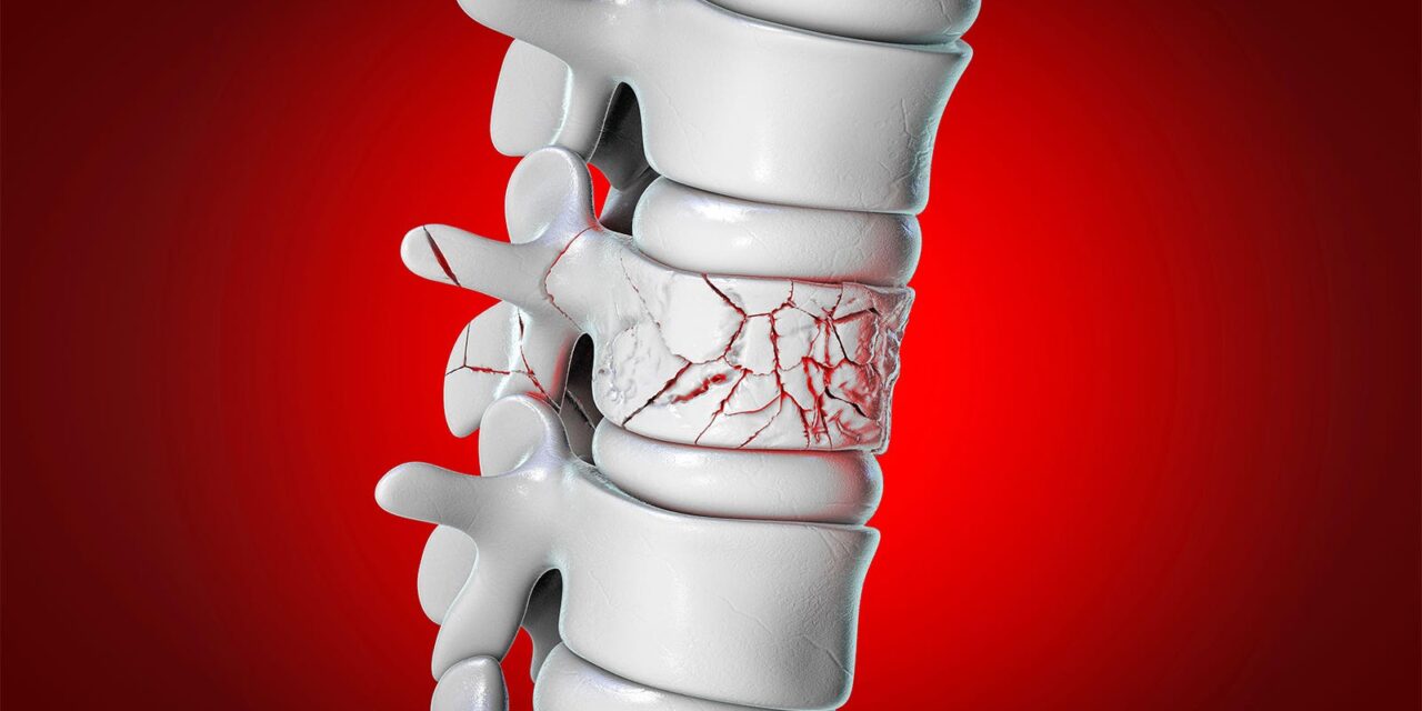 Infrequent Zoledronate Infusions Reduced Vertebral Fractures Soon After Menopause